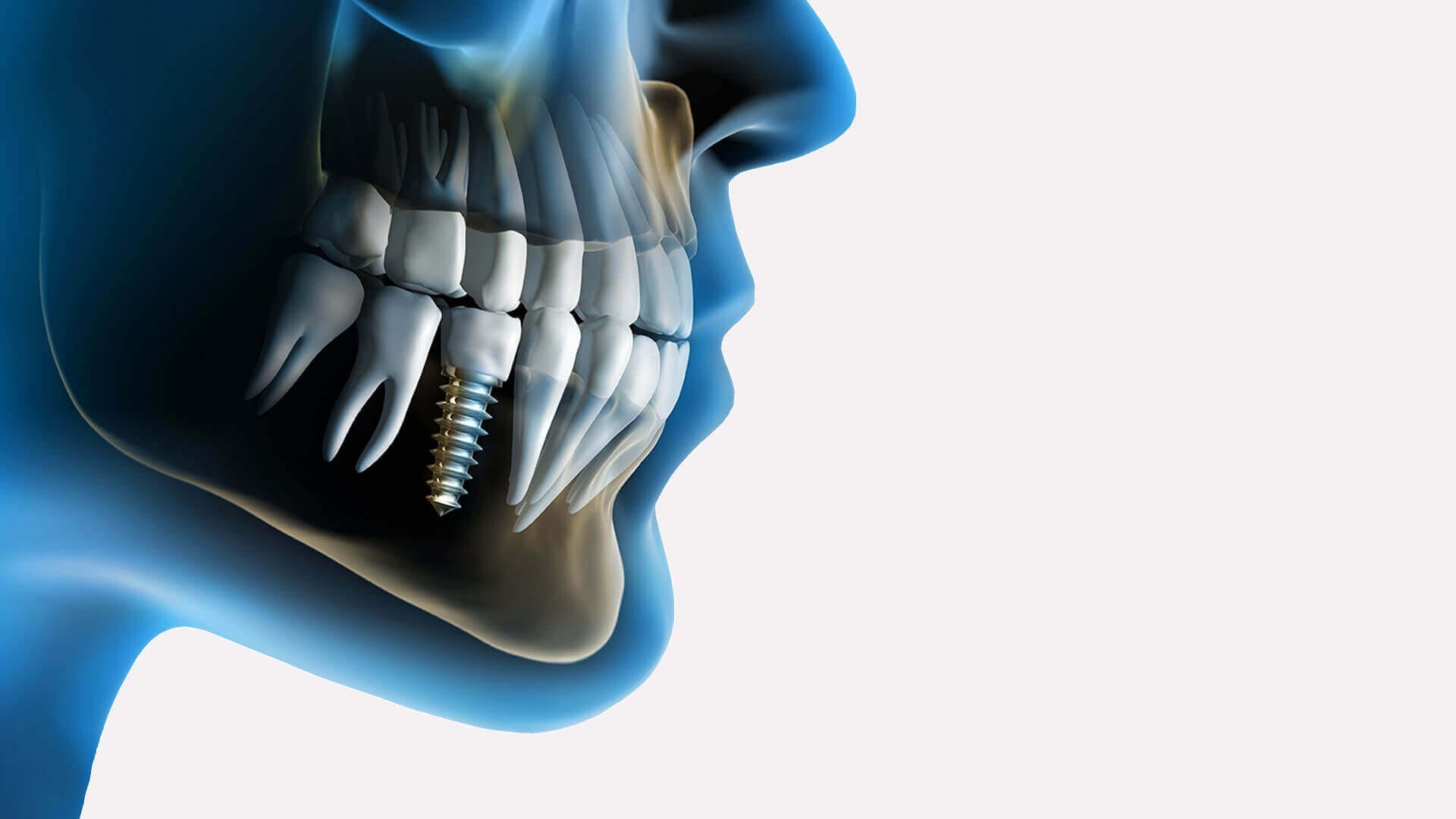 You are currently viewing Cea mai moderna investigatie radiologica din medicina dentara prezenta de 1 an la noi in clinica!